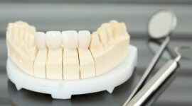 前歯の治療に使用する被せ物