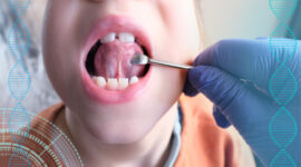 MFT（口腔筋機能療法）の説明をする歯科医師