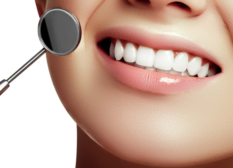 審美歯科治療で美しくなった歯のイメージ