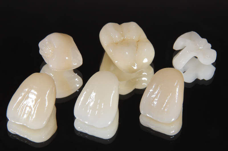 部位や形など様々な種類のセラミックの歯