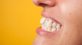 出っ歯の男性の口元