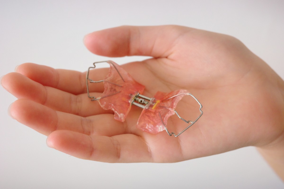 床矯正で使用する器具