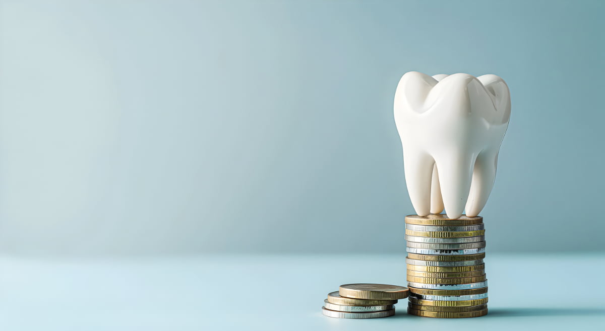 歯のクリーニングにかかる料金のイメージ