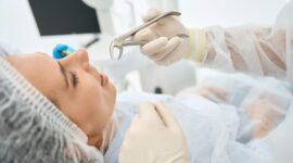 虫歯を抜歯している様子